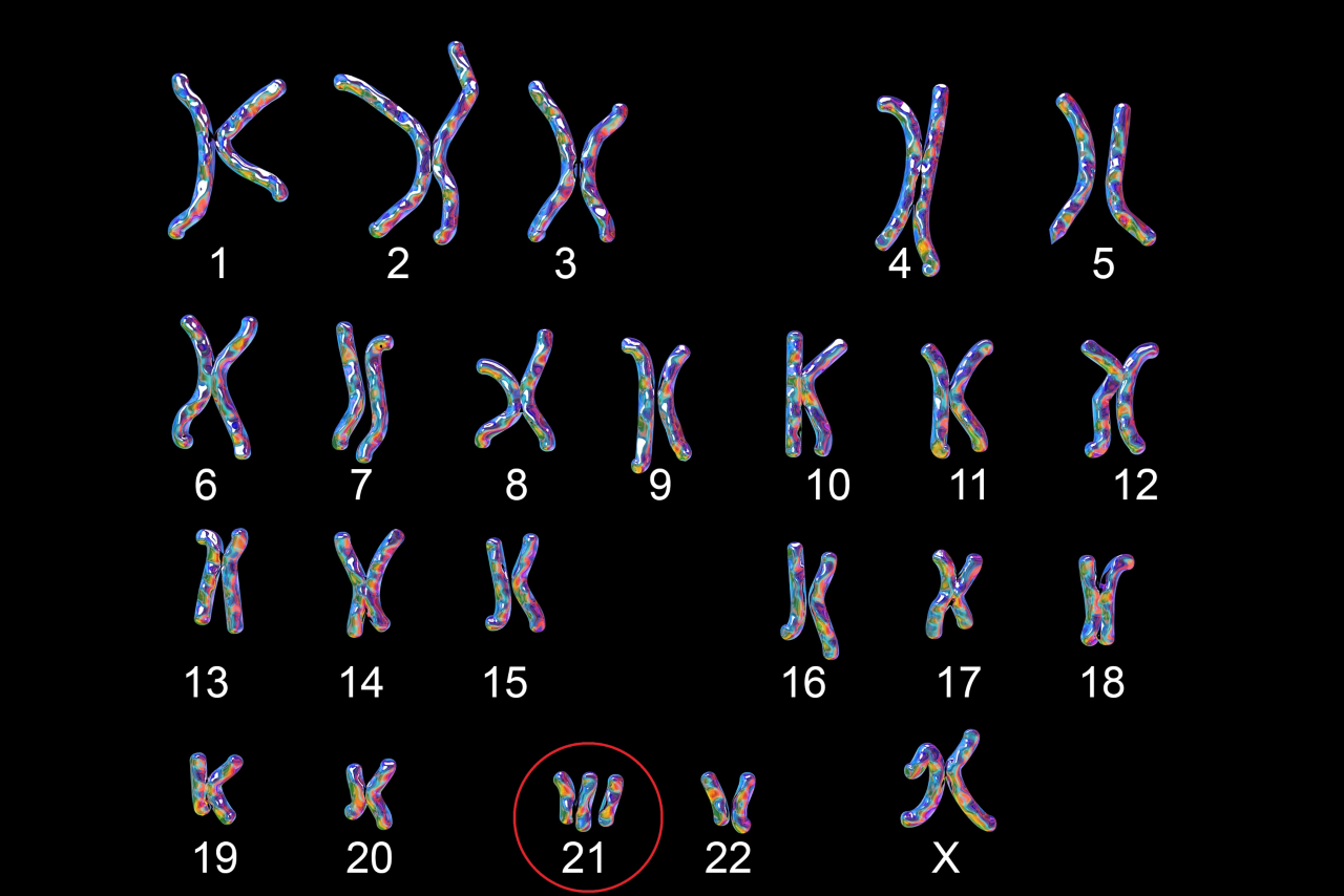Down-syndrome karyotype, female, labeled, isolated on black background. Trisomy 21. 3D illustration