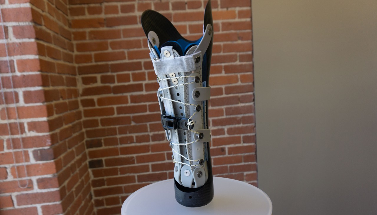 Connecting to comfort Martin Bionics pioneers new type of prosthetic socket for amputees